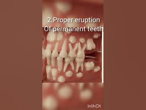 Why to treat milk teeth?? Care & Treatment of Milk teeth #dentistry #