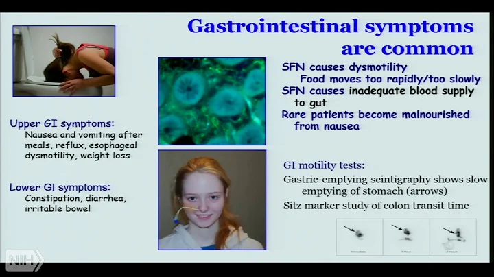 Dr. Anne Louise Oaklander - Small-fiber Neuropathy...