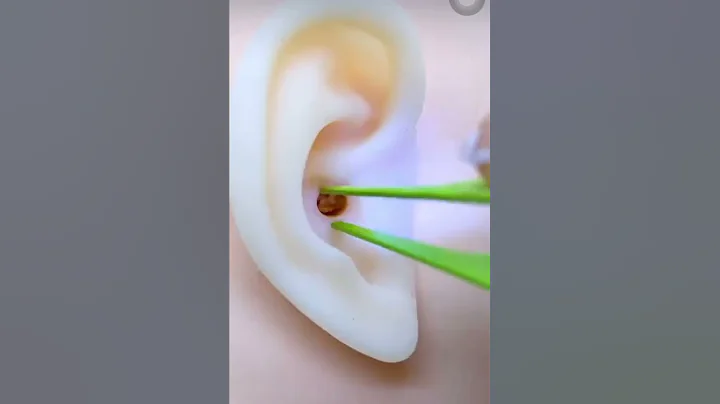 4 Pack Ear Wax Removal Tool Kit with Light, Ear Pick Ear Cleaning Tools Set for Kids and Adults