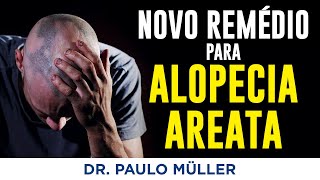 Ritlecitinib, Novo Medicamento para Alopecia Areata – Dr. Paulo Muller Dermatologista.