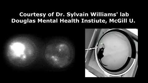 Neurescence Quartet® - Cylinder Test- Simultaneous multi-region Calcium Imaging of Neurons