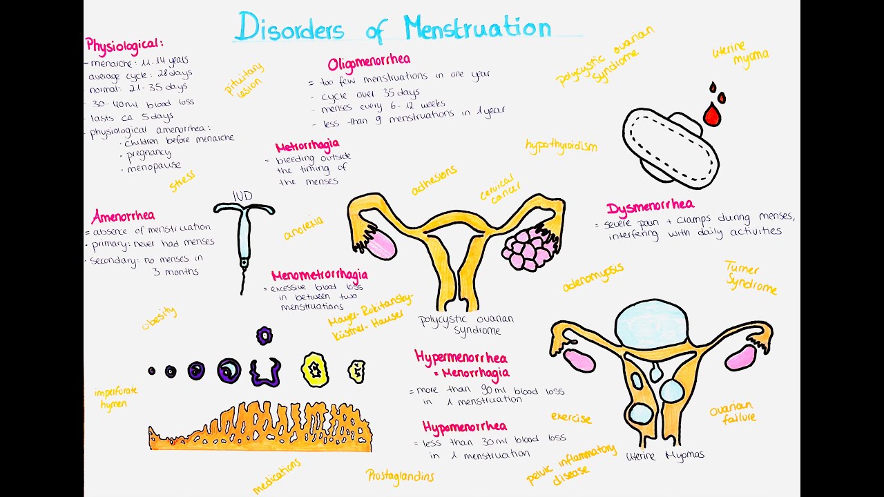 Menstruation Physiology And Disorders Amenorrhea Oligomenorrhea