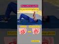 What is Breaking the Water or Amniotomy ? #birthprep #laboranddelivery #shorts #pregnancy #viral