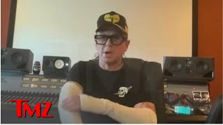 Sid Wilson's First Slipknot Show After Burns Was Painful, Risky ... And Totally Worth It! Details