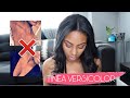 TALKING ABOUT MY BIGGEST INSECURITY | TINEA VERSICOLOR