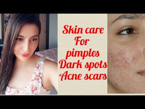 Summer Skin Care Routine for Oily/ acne prone skin