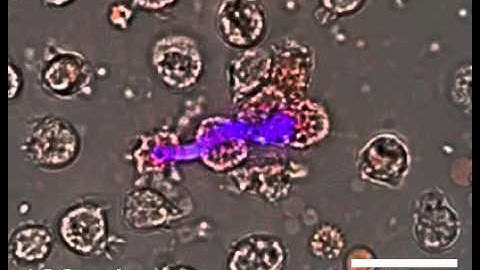 Kinetic of NET formation by human neutrophils in vitro