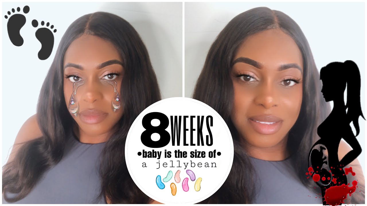 PREGNANCY UPDATE BLEEDING FIRST TRIMESTER BLEEDING SUBCHORIONIC pregnancy-update-bleeding-first-trimester-bleeding-subchorionic