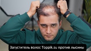 Загуститель волос Toppik! Уникальное средство! Избавление от лысины за 30 секунд!