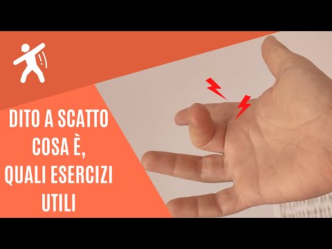 Video: Tendinite Al Dito: Diagnosi, Chirurgia E Grilletto