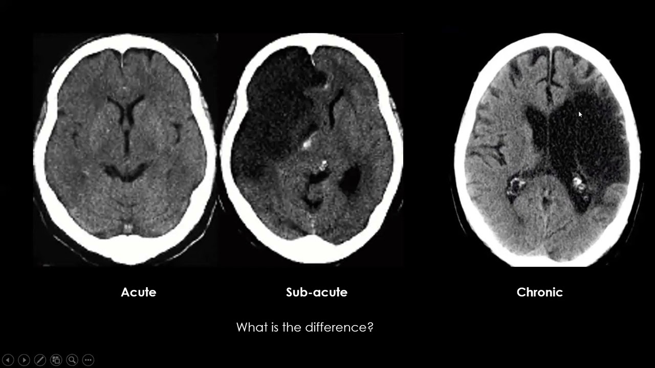 lecture 2-2 Prof Dr Mohamed Hamdy