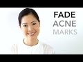 Fade and Minimize Acne Marks | PIE vs PIH