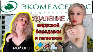 Удаление вирусной бородавки и папиллом кожи шеи, аксилярных областей/Показываю результаты поэтапно