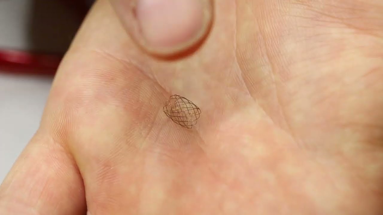 How To Fabricate a Neurovascular Implant - Part 1: Braiding