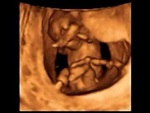 Baby Im 3d Ultraschall In Der 12 Ssw Youtube