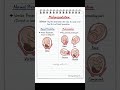 #mal presentation #types of mal presentation # important for nursing notes viral trending reels #