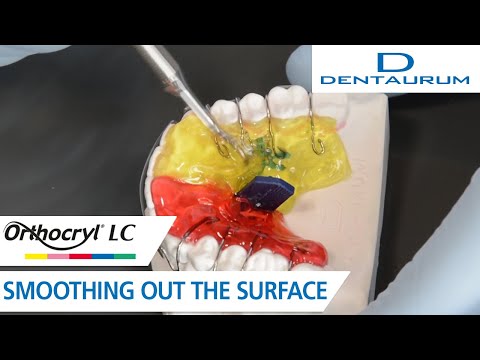 Orthocryl® LC – smoothing out the surface (orthodontic appliance)