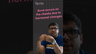 Why do women get pimples in pregnancy? | Dr Jay Mehta: Shree IVF clinic Mumbai