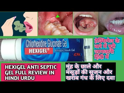 HEXIGEL GEL FULL REVIEW IN HINDI URDU BEST MEDICINE TO TREAT FOR MOUTH ULCER AND GUM SWELLING SMELLS