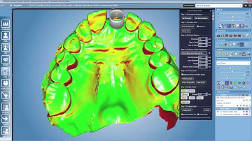 3D Implant Planning and Guide Designing in Planmeca Romexis