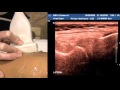 How To Ultrasound of the Knee