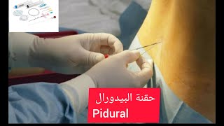 ابرة الظهر لتخفيف الام الولادة سلبياتها وايجابيتها  (pidural)