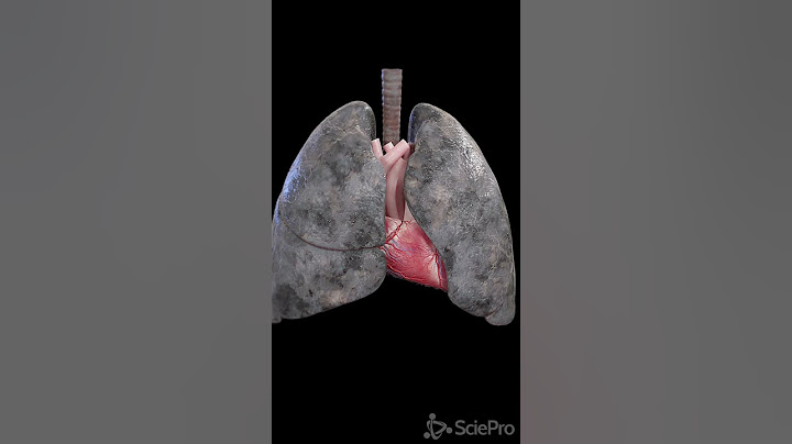 Stop smoking! Anatomy of a smoker´s lung.  #anatomy #meded #3danimation