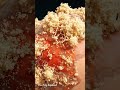 Dandruff: Skin & Fungal Science Explained #Dandruff #ScalpHealth #HairCare #MedicalCGI
