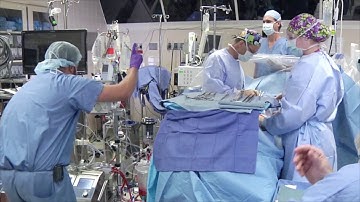 Initiation of Cardiopulmonary Bypass – Poor