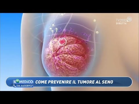 Il Mio Medico - Come prevenire il tumore al seno