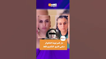التقرير الطبي يفضح السمسار صوفيا طالوني دار للمرحومة التكتوكر سلمى التيبو التكميم فقط 