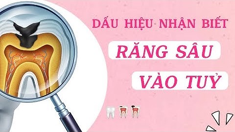 Dấu hiệu nhận biết răng sâu ăn vào tủy | Tt niềng răng quốc tế Diamond