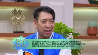 Dapon, Pria Berusia 21 Tahun Berwajah Seperti Lansia | FYP (29/09/22) Part 3