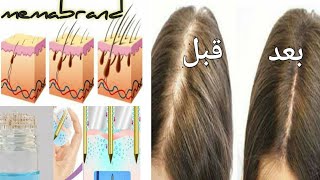 معجزه بديل زراعه الشعر بديل جلسات ديرما بن للشعر في البيت بدون الم