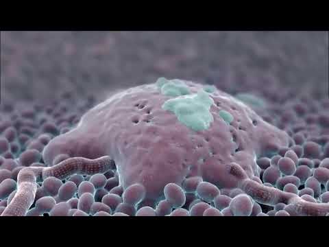Vidéo: Glioblastome: Taux De Survie, Traitements Et Causes