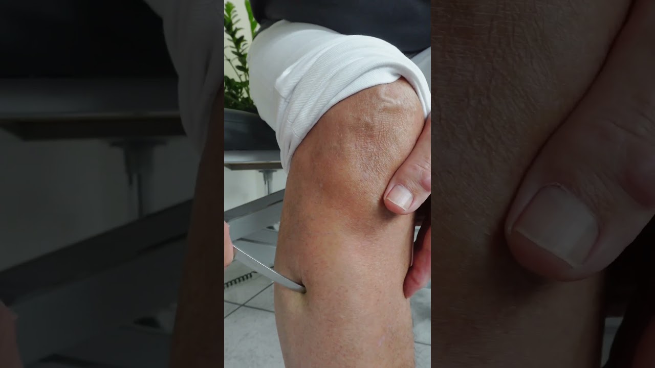 Du hast Beinschmerzen? SO hilft dir der Punkt der 3 D&ouml;rfer!