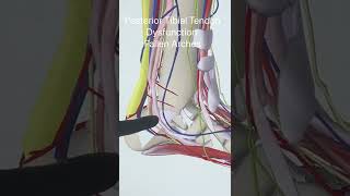 Fallen Arches, Posterior Tibial Tendon Dysfunction - YouTube Shorts