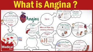 Pharmacology - What is Angina Pectoris ? Types of Angina, Symptoms, Causes &Treatment FROM A TO Z