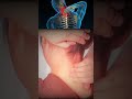 cervical spondylosis neck exercises #physiotherapy #acupressure #relax #cervicalspine #spondylitis