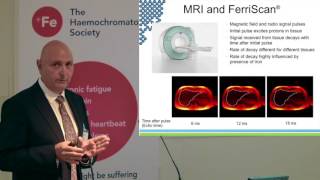 The Haemochromatosis Society Conference 2016 (6) Dr Sherif Boulos