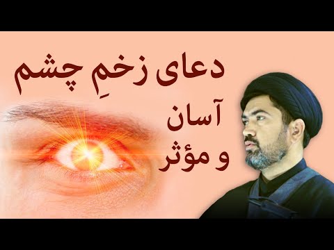 تصویری: چگونه خود را از چشم بد محافظت کنیم