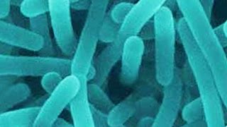 Update on food-borne listeria outbreaks