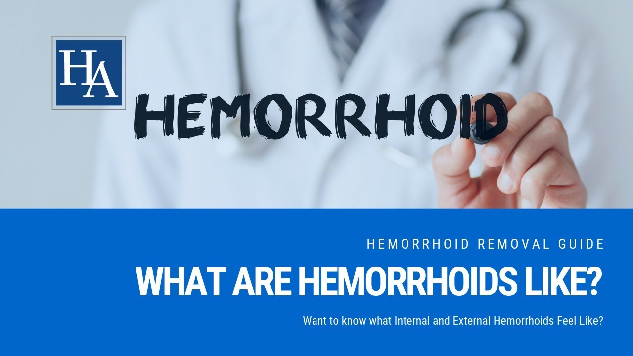 What Are Hemorrhoids Like? Want to know what Internal and External