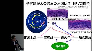 子宮頸がん　異形成から浸潤がんまで その診断・治療