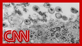 First new HIV strain discovered in nearly two decades Wealth
