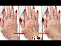 इस सीरम को लगाने के बाद झुर्रिया, झांईयों का काम तमाम, Best Ant-aging serum, Remove wrinkles,pimples