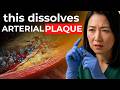 "Doctors Were WRONG About Heart Disease" – Eat These 7 Foods To CLEAN Arteries Naturally | Dr. Leana