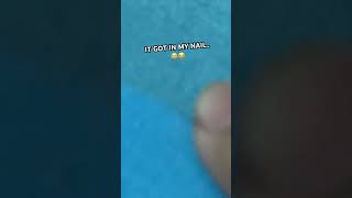 What Is This Bug It Got In My Frickin Nail