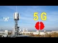 СОЖГУТ ЛИ НАШИ МОЗГИ ВЫШКИ  5 G ! ?