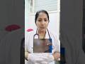 Melasma ..What to do?by DrAshishBShetty #drdivya #drdivyat #doctor #healthtip #skincare #melasma